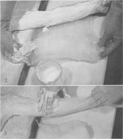 https://cdn.ncbi.nlm.nih.gov/pmc/blobs/8b0e/1397324/5c082527b346/annsurg00404-0063-a.jpg