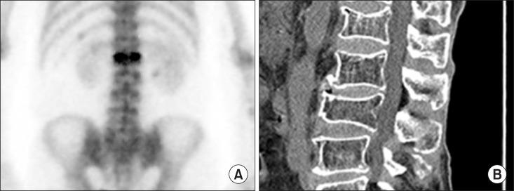 https://cdn.ncbi.nlm.nih.gov/pmc/blobs/8b1a/5532523/4294d51eae2c/kjpain-30-165-g004.jpg