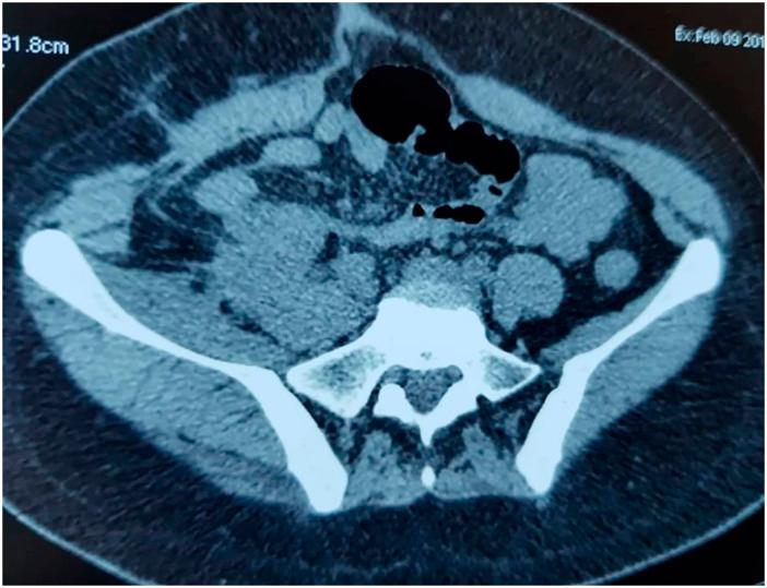 https://cdn.ncbi.nlm.nih.gov/pmc/blobs/8b27/9237920/f303642ef30b/10.1177_20363613221110837-fig3.jpg