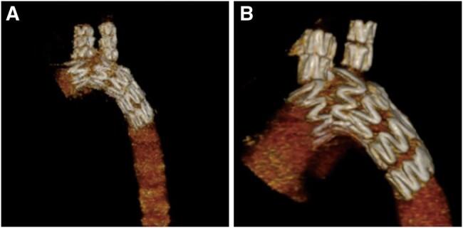 https://cdn.ncbi.nlm.nih.gov/pmc/blobs/8b2b/11014789/a5a8350e0c64/ivae049f5.jpg
