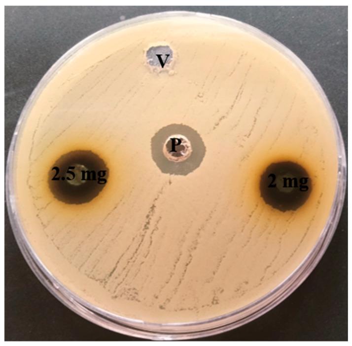 https://cdn.ncbi.nlm.nih.gov/pmc/blobs/8b30/11766900/58c69b9acede/life-15-00035-g006.jpg