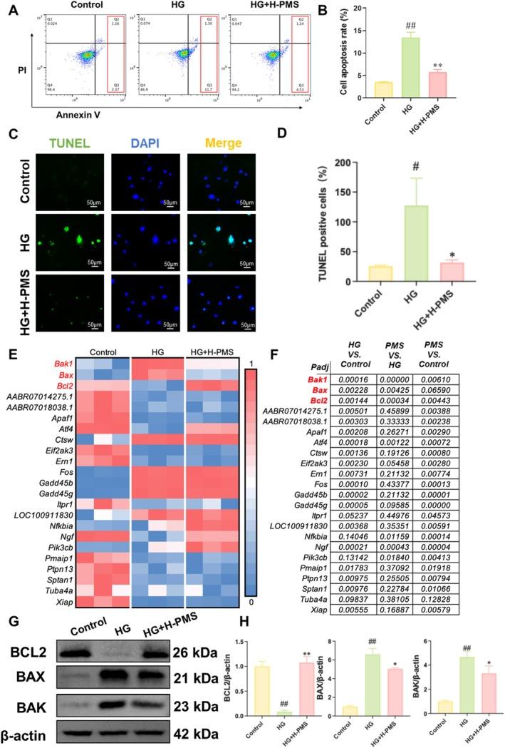 https://cdn.ncbi.nlm.nih.gov/pmc/blobs/8b35/12034938/426a81e4abbc/JCMM-29-e70571-g008.jpg