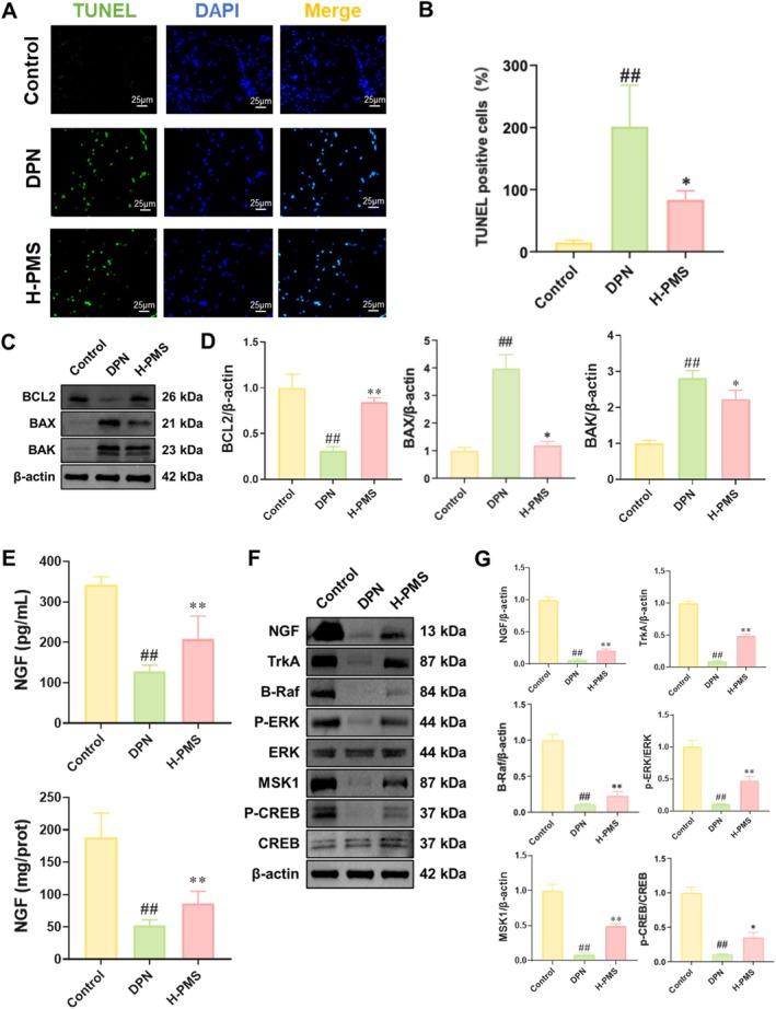 https://cdn.ncbi.nlm.nih.gov/pmc/blobs/8b35/12034938/cee5ab216ae5/JCMM-29-e70571-g003.jpg