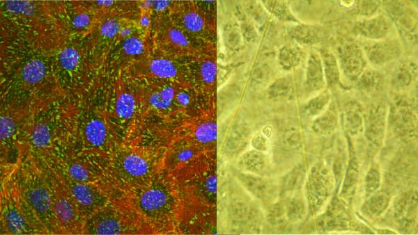 https://cdn.ncbi.nlm.nih.gov/pmc/blobs/8b38/3260089/c26164ffae39/1754-1611-5-16-2.jpg