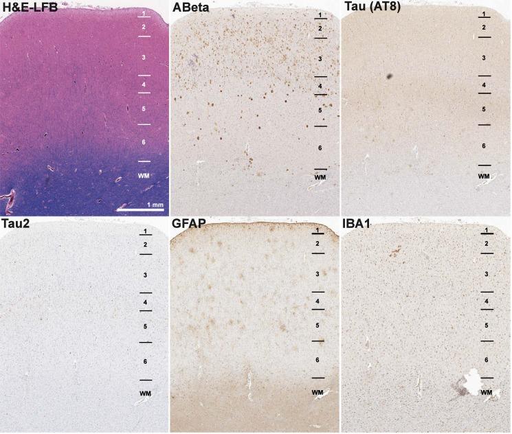 https://cdn.ncbi.nlm.nih.gov/pmc/blobs/8b46/5679757/6b75b20b0401/elife-31126-fig1-figsupp1.jpg