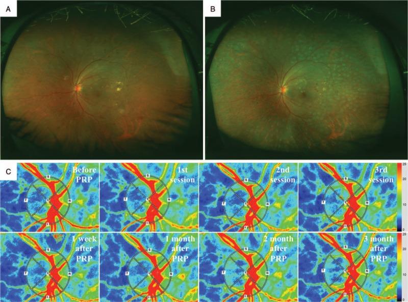 https://cdn.ncbi.nlm.nih.gov/pmc/blobs/8b49/6587595/f9b47e1cffb9/medi-98-e16062-g003.jpg