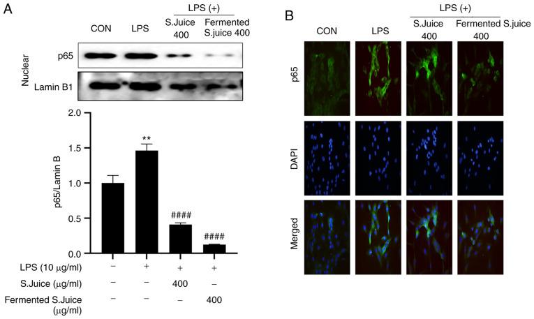 https://cdn.ncbi.nlm.nih.gov/pmc/blobs/8b4c/9019603/bf24308d6e42/etm-23-06-11317-g04.jpg