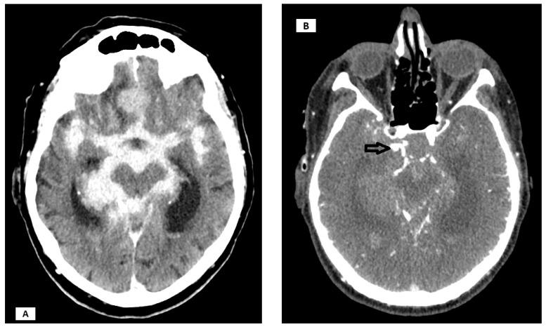 https://cdn.ncbi.nlm.nih.gov/pmc/blobs/8b4f/12428454/192428645300/cancers-17-02908-g003.jpg