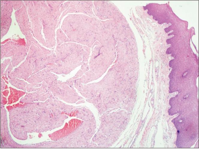 https://cdn.ncbi.nlm.nih.gov/pmc/blobs/8b5e/6024062/7eb43ccd8bb6/jkaoms-44-136-g002.jpg