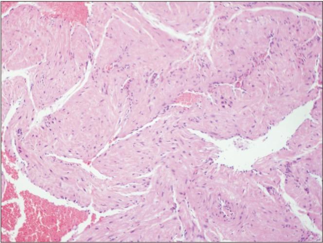 https://cdn.ncbi.nlm.nih.gov/pmc/blobs/8b5e/6024062/df2f24a27eb7/jkaoms-44-136-g003.jpg