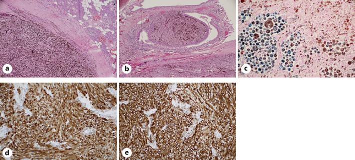 https://cdn.ncbi.nlm.nih.gov/pmc/blobs/8b61/8261259/6bb16b006865/cro-0014-0957-g01.jpg