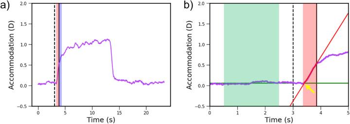 https://cdn.ncbi.nlm.nih.gov/pmc/blobs/8b65/7705395/45db10927234/iovs-61-13-38-f003.jpg