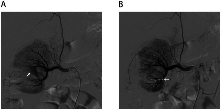 https://cdn.ncbi.nlm.nih.gov/pmc/blobs/8b6d/12321514/3a030f3801f2/fmed-12-1632764-g004.jpg
