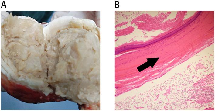 https://cdn.ncbi.nlm.nih.gov/pmc/blobs/8b6d/12321514/5a2f3fe48eca/fmed-12-1632764-g002.jpg