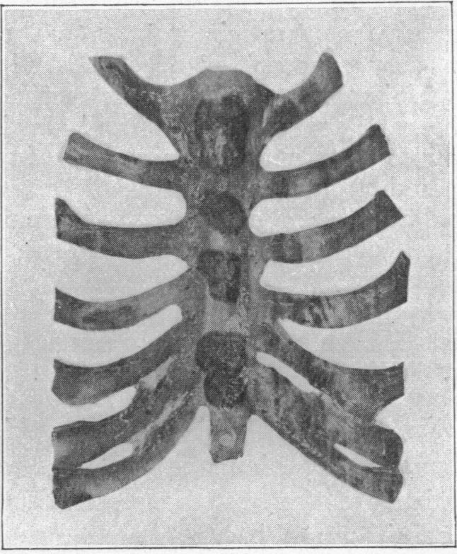 https://cdn.ncbi.nlm.nih.gov/pmc/blobs/8b74/1249748/42c855c1f232/janat00638-0098-a.jpg