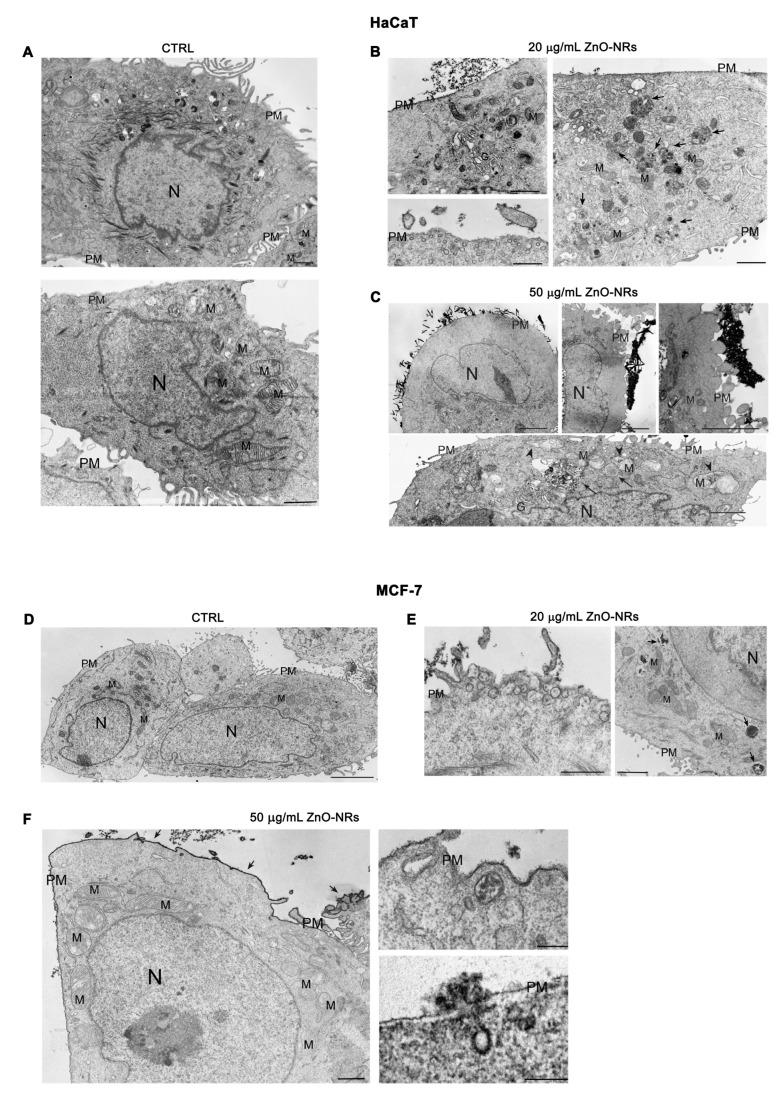 https://cdn.ncbi.nlm.nih.gov/pmc/blobs/8b77/10138614/01f1215946ed/ijms-24-06971-g003.jpg