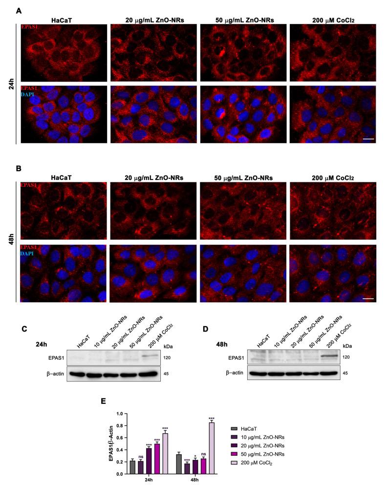 https://cdn.ncbi.nlm.nih.gov/pmc/blobs/8b77/10138614/1b155afdd187/ijms-24-06971-g006.jpg