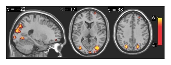 https://cdn.ncbi.nlm.nih.gov/pmc/blobs/8b77/3384885/347e91925b2c/NP2012-304045.004.jpg