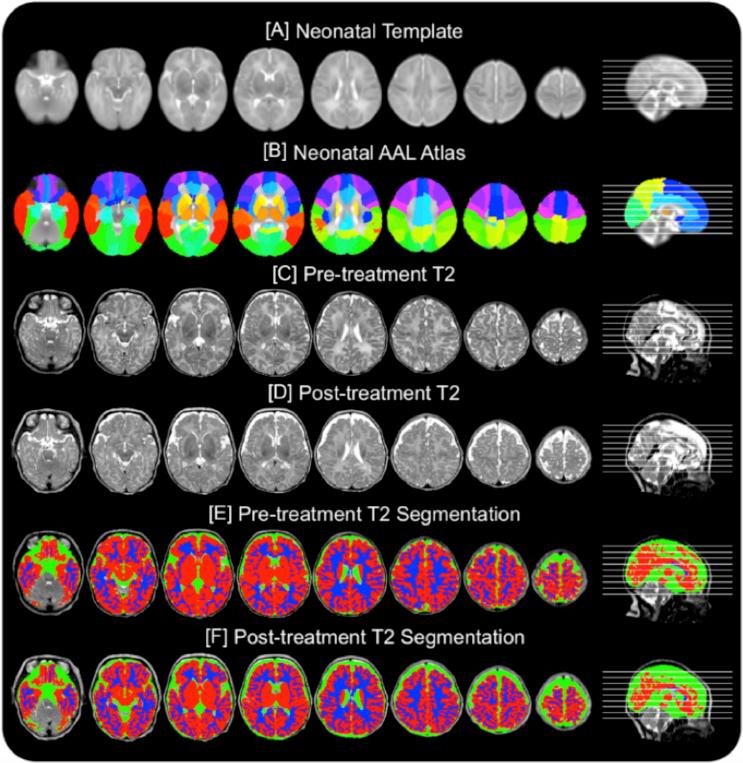https://cdn.ncbi.nlm.nih.gov/pmc/blobs/8b78/6716350/ab0a819c7f2e/gr3.jpg