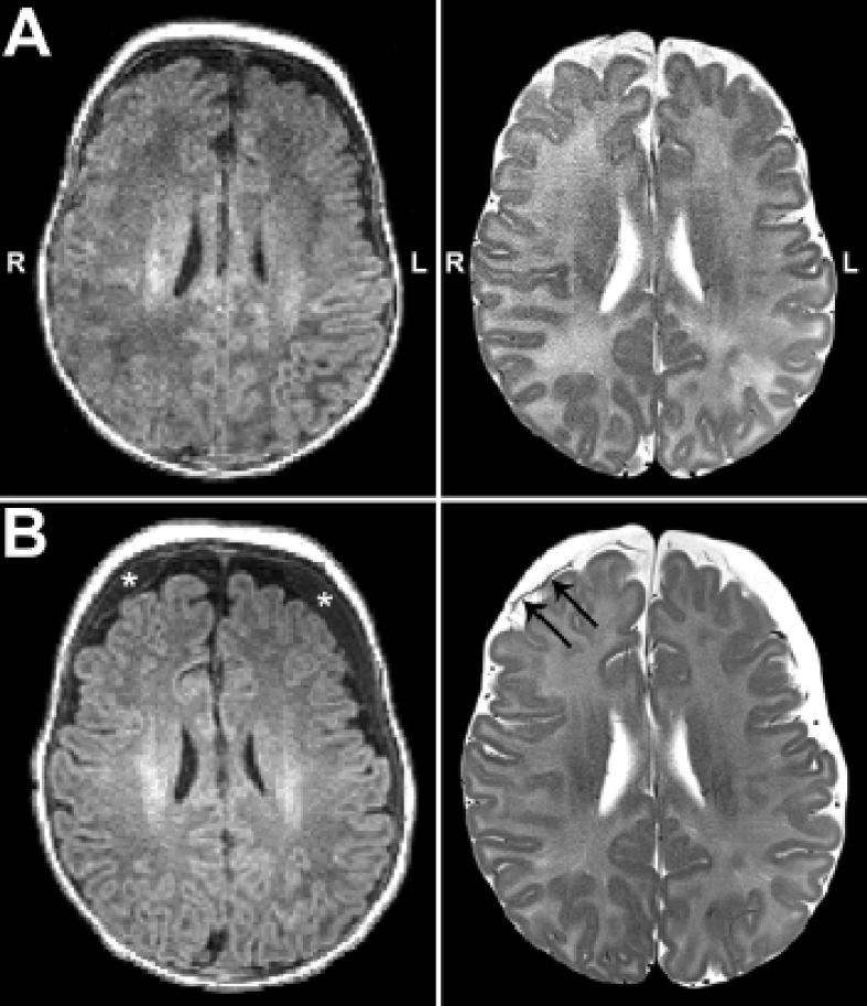 https://cdn.ncbi.nlm.nih.gov/pmc/blobs/8b78/6716350/e24c1400a3ec/gr2.jpg