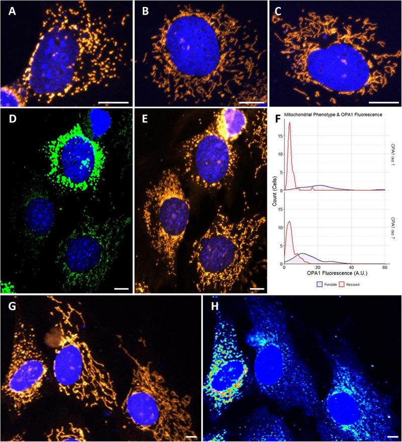 https://cdn.ncbi.nlm.nih.gov/pmc/blobs/8b78/7726421/aaeb88b39fc4/fnins-14-571479-g002.jpg