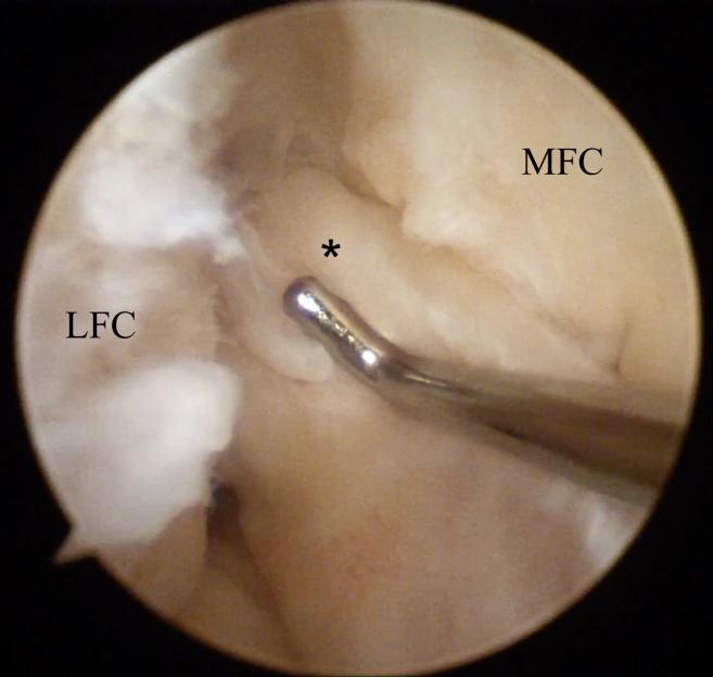 https://cdn.ncbi.nlm.nih.gov/pmc/blobs/8b7f/6993482/0cf05927ddd4/gr4.jpg