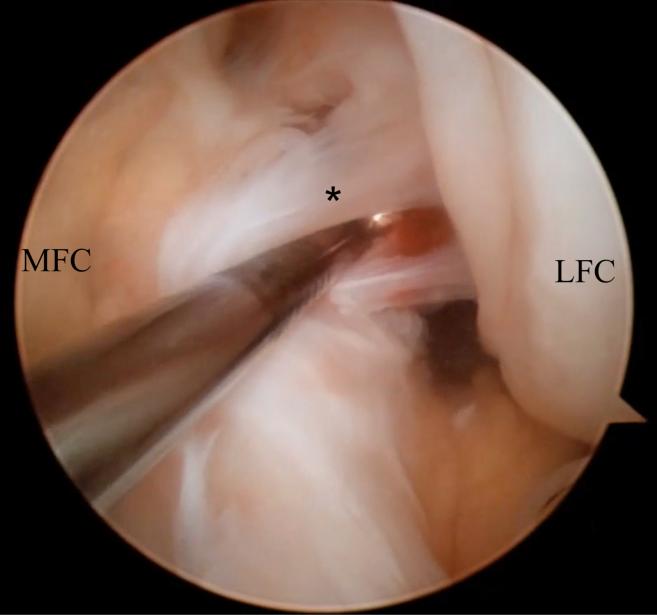 https://cdn.ncbi.nlm.nih.gov/pmc/blobs/8b7f/6993482/a66056abada0/gr2.jpg