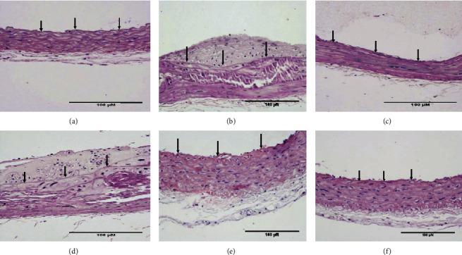 https://cdn.ncbi.nlm.nih.gov/pmc/blobs/8b7f/8580673/2c051013ed4b/ECAM2021-5524226.002.jpg