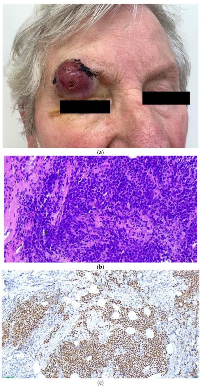 https://cdn.ncbi.nlm.nih.gov/pmc/blobs/8b89/9776808/b14b38d17521/cancers-14-06176-g003.jpg
