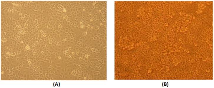 https://cdn.ncbi.nlm.nih.gov/pmc/blobs/8b9b/3622607/54b1940b35ac/pone.0060965.g001.jpg