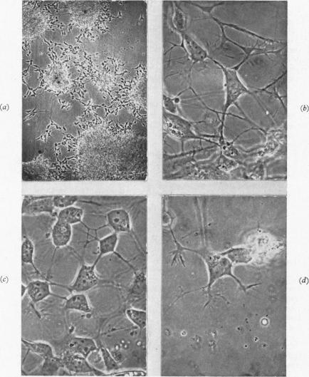 https://cdn.ncbi.nlm.nih.gov/pmc/blobs/8ba2/2019640/68e47394ea5a/archdisch01569-0086-a.jpg