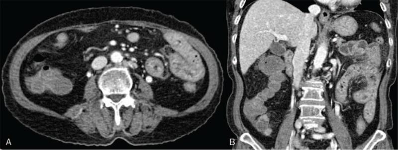 https://cdn.ncbi.nlm.nih.gov/pmc/blobs/8ba4/8568418/0ebb4e5a32be/medi-100-e27726-g002.jpg