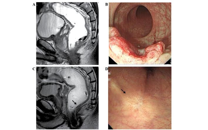 https://cdn.ncbi.nlm.nih.gov/pmc/blobs/8ba9/3834548/454bb95ccaac/OL-06-06-1573-g00.jpg