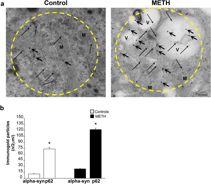 https://cdn.ncbi.nlm.nih.gov/pmc/blobs/8baa/11016004/5154b10fa6b9/702_2024_2741_Fig8_HTML.jpg