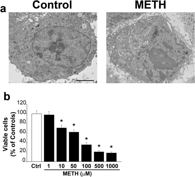 https://cdn.ncbi.nlm.nih.gov/pmc/blobs/8baa/11016004/6f930926b8f5/702_2024_2741_Fig2_HTML.jpg