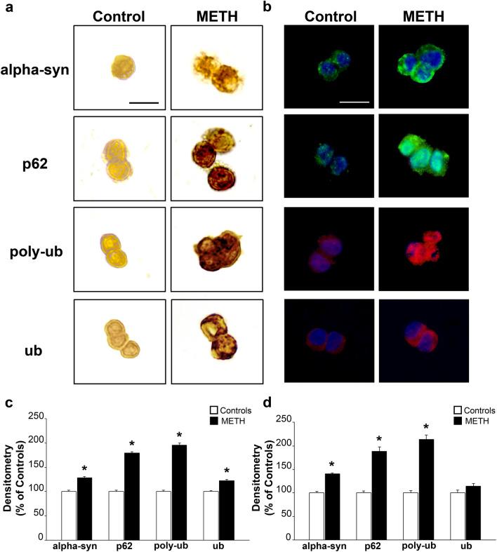 https://cdn.ncbi.nlm.nih.gov/pmc/blobs/8baa/11016004/7065da6e39b4/702_2024_2741_Fig4_HTML.jpg