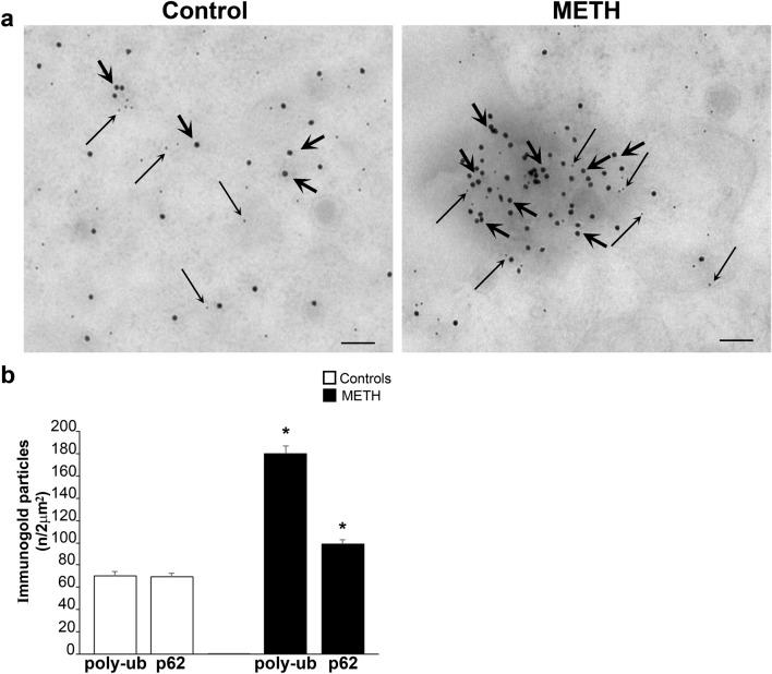 https://cdn.ncbi.nlm.nih.gov/pmc/blobs/8baa/11016004/dc86bccd6e13/702_2024_2741_Fig10_HTML.jpg