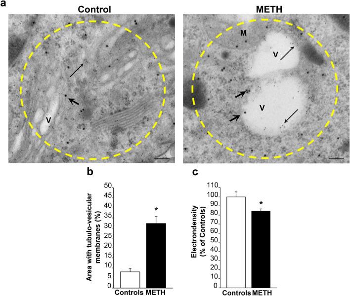 https://cdn.ncbi.nlm.nih.gov/pmc/blobs/8baa/11016004/dd73d509ddb7/702_2024_2741_Fig11_HTML.jpg