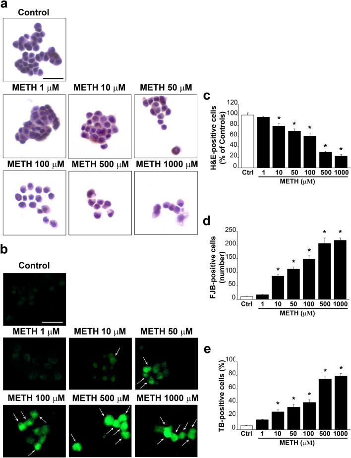 https://cdn.ncbi.nlm.nih.gov/pmc/blobs/8baa/11016004/e84f30702d19/702_2024_2741_Fig1_HTML.jpg