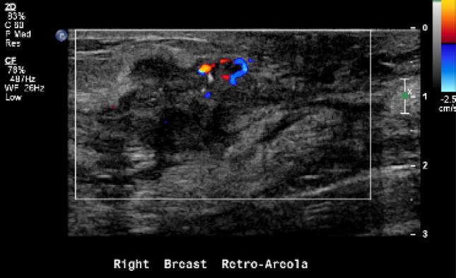https://cdn.ncbi.nlm.nih.gov/pmc/blobs/8bab/11043463/5fa413451350/44197_2023_169_Fig3_HTML.jpg