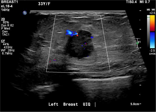https://cdn.ncbi.nlm.nih.gov/pmc/blobs/8bab/11043463/7d5da9b45162/44197_2023_169_Fig4_HTML.jpg