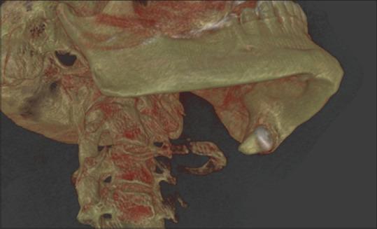 https://cdn.ncbi.nlm.nih.gov/pmc/blobs/8bae/9527841/2f74877ca955/AMS-12-117-g003.jpg
