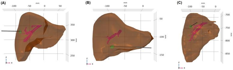 https://cdn.ncbi.nlm.nih.gov/pmc/blobs/8bb3/11171243/614238adc83b/cancers-16-02095-g002.jpg