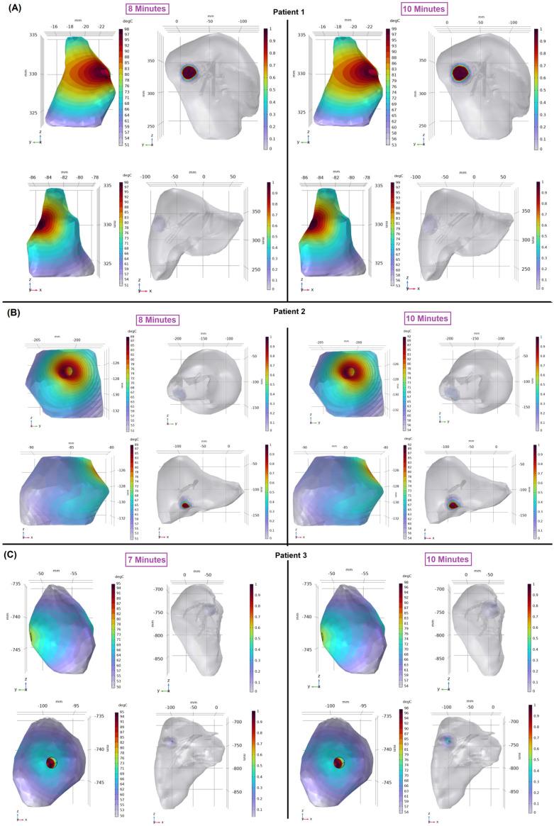 https://cdn.ncbi.nlm.nih.gov/pmc/blobs/8bb3/11171243/bbc15c323d90/cancers-16-02095-g004.jpg