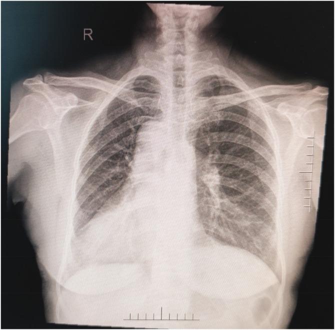 https://cdn.ncbi.nlm.nih.gov/pmc/blobs/8bb4/8969507/e9d88cefd81b/10.1177_03000605221088551-fig3.jpg