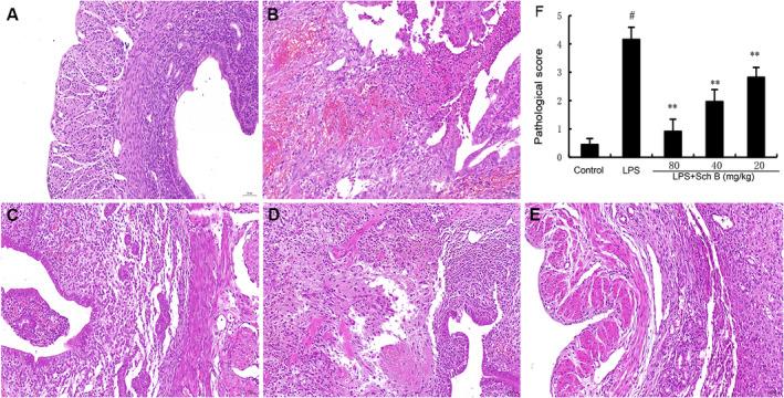 https://cdn.ncbi.nlm.nih.gov/pmc/blobs/8bbe/11628352/058f8e717ad4/JCMM-28-e70281-g003.jpg