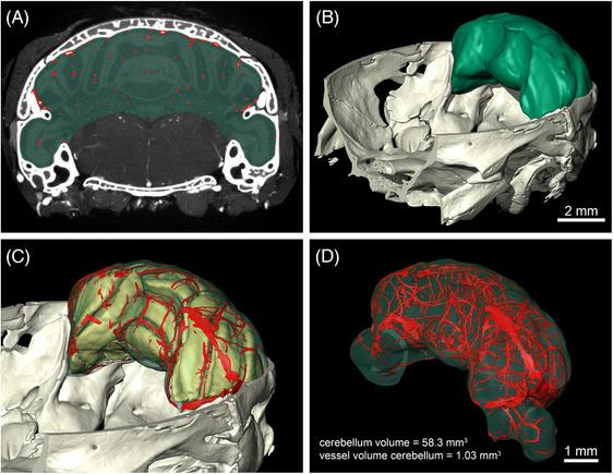 https://cdn.ncbi.nlm.nih.gov/pmc/blobs/8bc0/11733848/1e38e325f3d2/JMI-297-179-g002.jpg