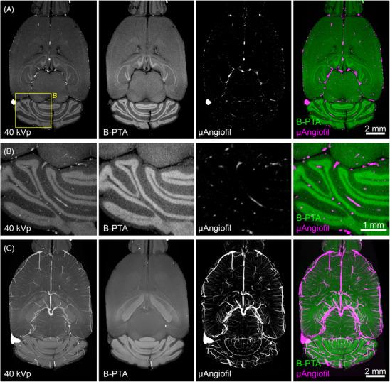 https://cdn.ncbi.nlm.nih.gov/pmc/blobs/8bc0/11733848/7a90b09eb582/JMI-297-179-g003.jpg