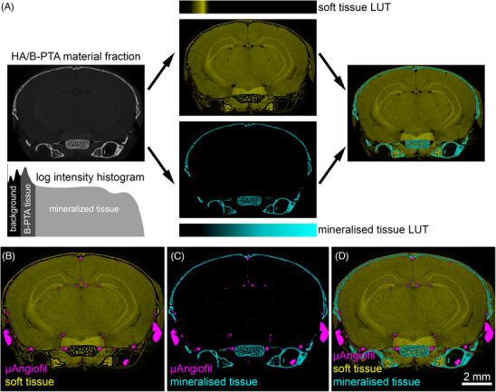 https://cdn.ncbi.nlm.nih.gov/pmc/blobs/8bc0/11733848/ebddc25374b1/JMI-297-179-g005.jpg