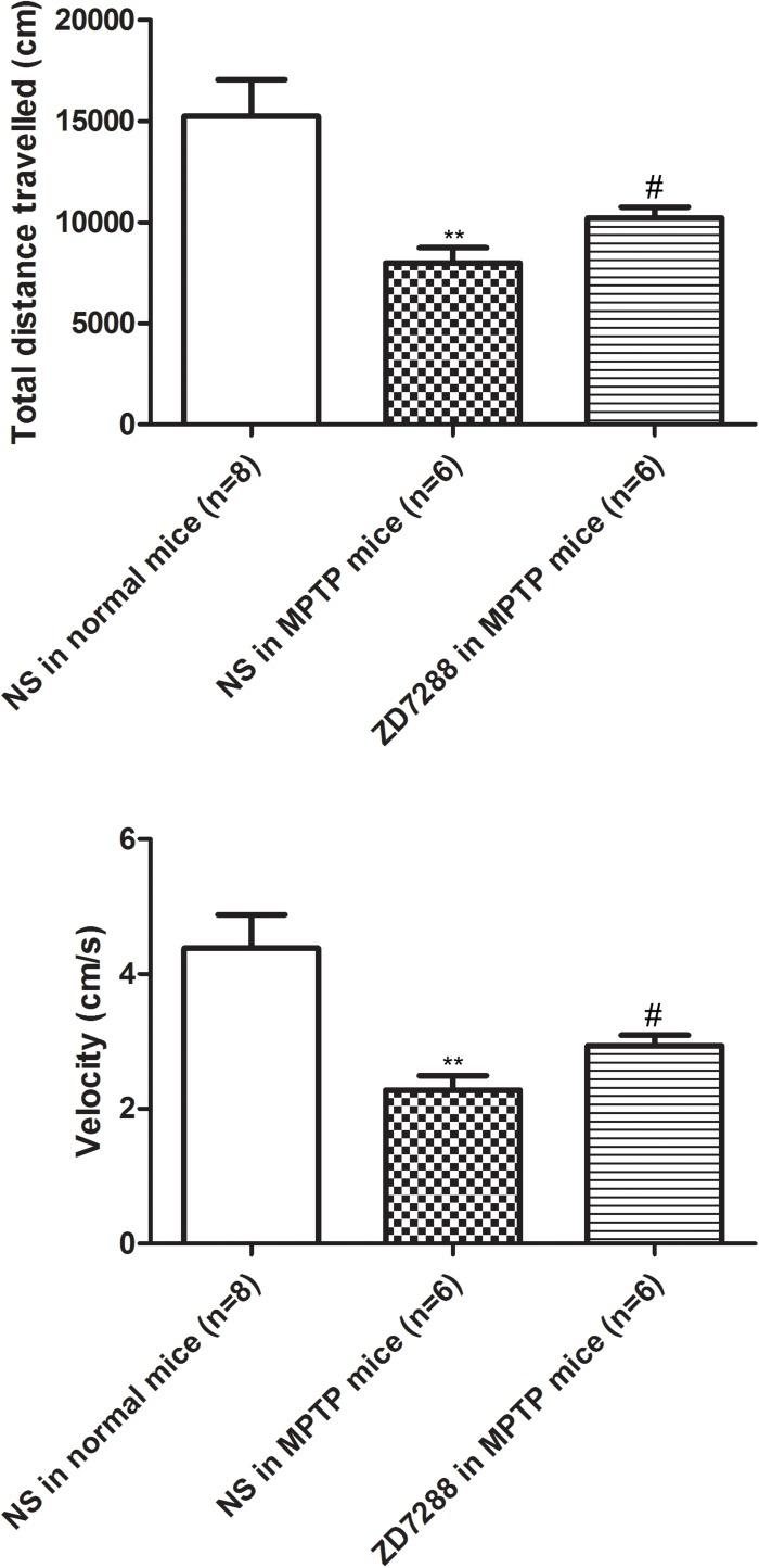 https://cdn.ncbi.nlm.nih.gov/pmc/blobs/8bc0/6670024/1da1c41c11ae/fnagi-11-00190-g006.jpg